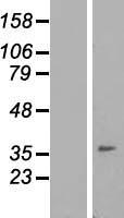 TMEM149 (IGFLR1) Human Over-expression Lysates NM_024660