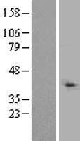TBLR1 (TBL1XR1) Human Over-expression Lysates NM_024665
