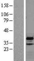 ls079720 vps37b human over expression lysates nm 024667 wb testing 1