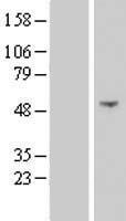 NSUN7 Human Over-expression Lysates NM_024677