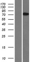 BBS10 Human Over-expression Lysates NM_024685