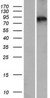 ZBBX Human Over-expression Lysates NM_024687