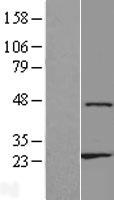 ls079750 znf385d human over expression lysates nm 024697 wb testing 1