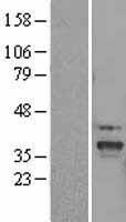 SLC25A22 Human Over-expression Lysates NM_024698