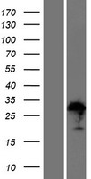 ZFAND1 Human Over-expression Lysates NM_024699