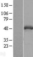 SNIP1 Human Over-expression Lysates NM_024700