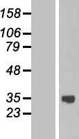 ASB13 Human Over-expression Lysates NM_024701