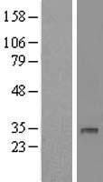 DHRS12 Human Over-expression Lysates NM_001031719