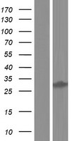 DHRS12 Human Over-expression Lysates NM_024705