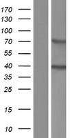 ACBD4 Human Over-expression Lysates NM_001135706