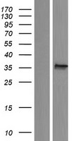 ACBD4 Human Over-expression Lysates NM_001135707