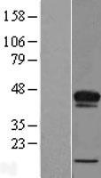 ls079777 acbd4 human over expression lysates nm 024722 wb testing 1