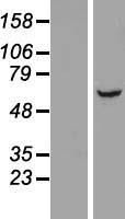 LRRC31 Human Over-expression Lysates NM_024727