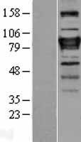 ZNF408 Human Over-expression Lysates NM_024741