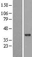 VASH2 Human Over-expression Lysates NM_024749