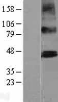 ls079810 ptcd2 human over expression lysates nm 024754 wb testing 1