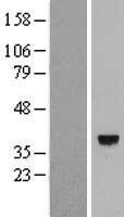 CLNMT (CAMKMT) Human Over-expression Lysates NM_024766