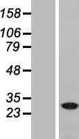 NAA40 Human Over-expression Lysates NM_024771