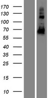 CCDC102B Human Over-expression Lysates NM_001093729