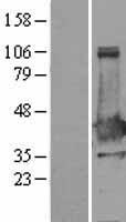 XLF (NHEJ1) Human Over-expression Lysates NM_024782