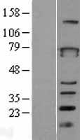 ZBTB3 Human Over-expression Lysates NM_024784