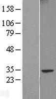 FAM124B Human Over-expression Lysates NM_024785