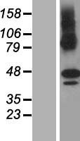 ls079844 zdhhc11 human over expression lysates nm 024786 wb testing 1