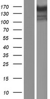 CSPP1 Human Over-expression Lysates NM_024790