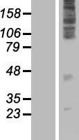 ls079850 tlcd3a human over expression lysates nm 024792 wb testing 1