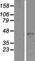ls079852 abhd9 ephx3 human over expression lysates nm 001142886 wb testing 2