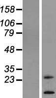 TM4SF20 Human Over-expression Lysates NM_024795