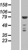 NEK11 Human Over-expression Lysates NM_024800