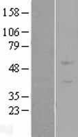 ls079862 znf669 human over expression lysates nm 024804 wb testing 1