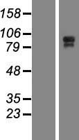 JHY Human Over-expression Lysates NM_024806