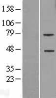 TREML2 Human Over-expression Lysates NM_024807