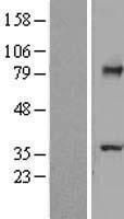 TCTN2 Human Over-expression Lysates NM_024809