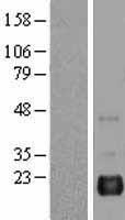 BAALC Human Over-expression Lysates NM_024812