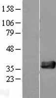 NUDT18 Human Over-expression Lysates NM_024815