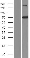 RABEP2 Human Over-expression Lysates NM_024816