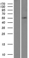UBA5 Human Over-expression Lysates NM_024818