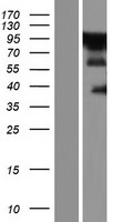 ZC3H14 Human Over-expression Lysates NM_001160104