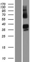 ZC3H14 Human Over-expression Lysates NM_207662