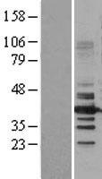 HDAC11 Human Over-expression Lysates NM_024827