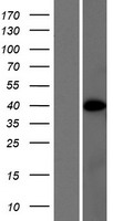 FLJ14213 (PRR5L) Human Over-expression Lysates NM_024841