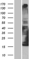 Cytochrome b reductase 1 (CYBRD1) Human Over-expression Lysates NM_001127383