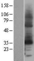 Cytochrome b reductase 1 (CYBRD1) Human Over-expression Lysates NM_024843