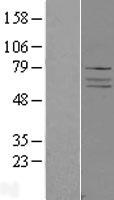 ADCK4 (COQ8B) Human Over-expression Lysates NM_024876