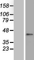 ls079943 znf696 human over expression lysates nm 030895 wb testing 1