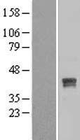 Dehydrodolichyl Diphosphate Synthase (DHDDS) Human Over-expression Lysates NM_024887