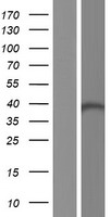 Dehydrodolichyl Diphosphate Synthase (DHDDS) Human Over-expression Lysates NM_205861